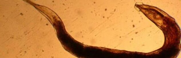 gusano parásito del cuerpo humano