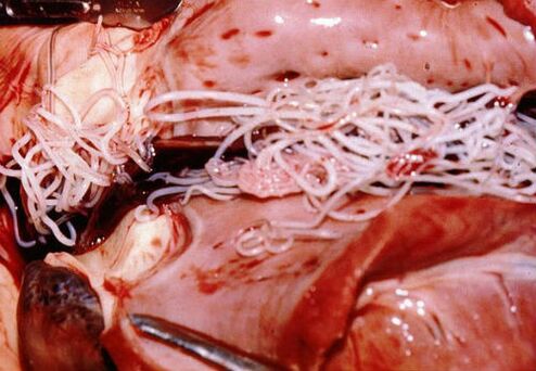 Parásitos en el cuerpo humano