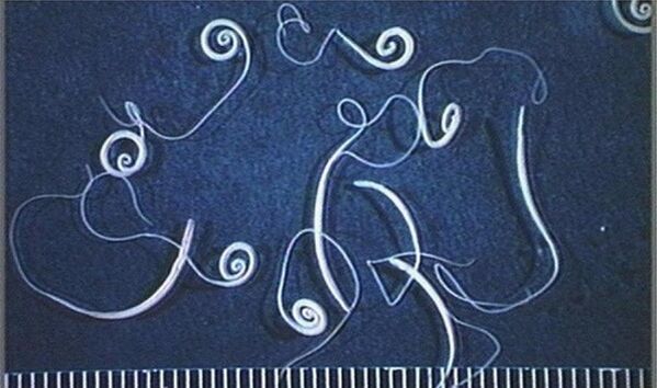 tricocéfalos del cuerpo humano