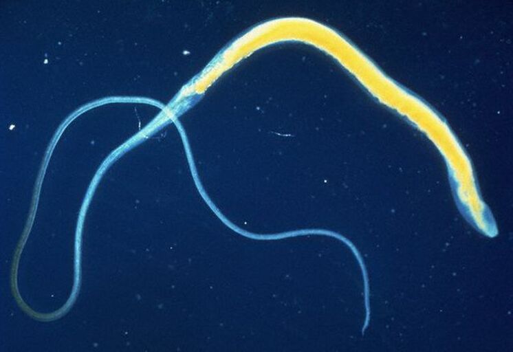 La tricocéfalo es un parásito intestinal común.