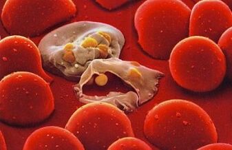 Plasmodium de la malaria en el cuerpo humano. 